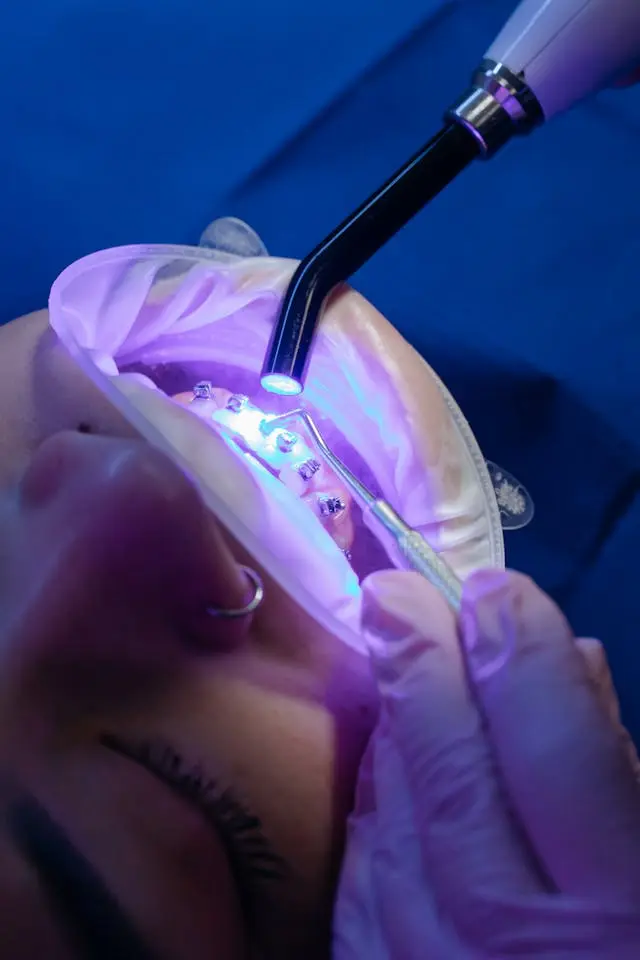 Blanqueamiento Dental en Turquía